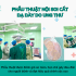 PHẪU THUẬT NỘI SOI CẮT DẠ DÀY DO UNG THƯ TẠI BỆNH VIỆN THÁI BÌNH