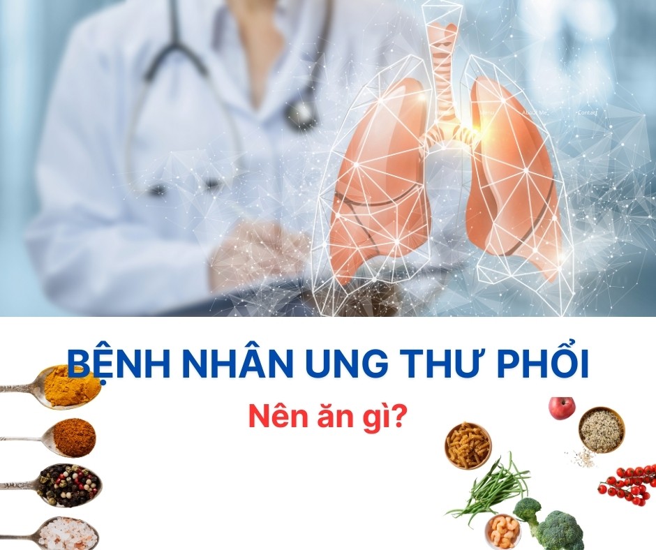 UNG THƯ PHỔI NÊN ĂN GÌ ĐỂ HỖ TRỢ ĐIỀU TRỊ?