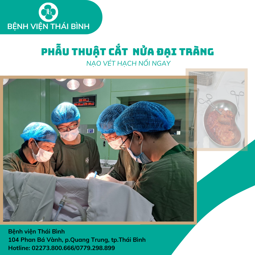 PHẪU THUẬT CẮT  NỬA ĐẠI TRÀNG PHẢI NẠO VÉT HẠCH NỐI NGAY