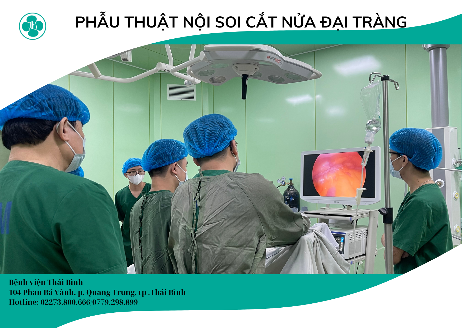 PHẪU THUẬT NỘI SOI CẮT NỬA ĐẠI TRÀNG BÊN PHẢI TẠI BỆNH VIỆN THÁI BÌNH
