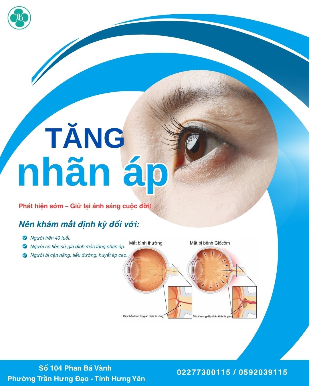 TĂNG NHÃN ÁP - KẺ CƯỚP THỊ LỰC THẦM LẶNG