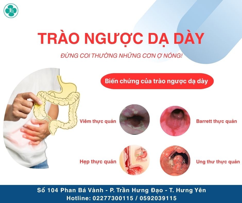 TRÀO NGƯỢC DẠ DÀY: ĐỪNG COI THƯỜNG NHỮNG CƠN Ợ NÓNG!