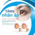TĂNG NHÃN ÁP - KẺ CƯỚP THỊ LỰC THẦM LẶNG